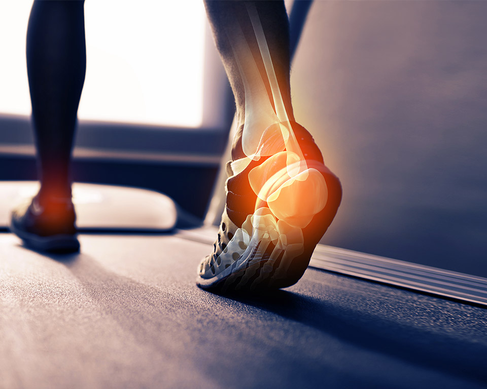 Heel Pain Problems in Mississauga and Orangeville